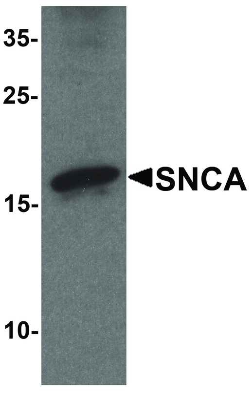 SNCA / Alpha-Synuclein Antibody - Western blot analysis of SNCA in mouse cerebellum tissue lysate with SNCA antibody at 1 ug/ml.