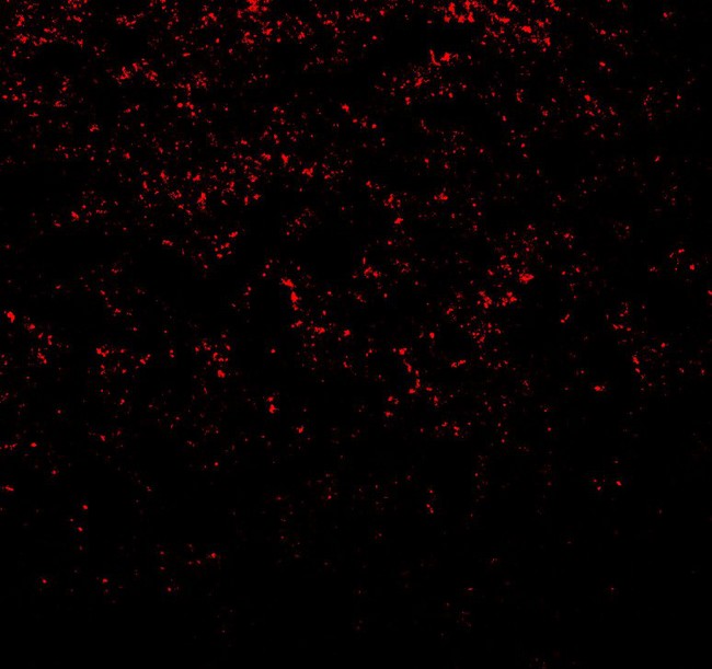 SNCA / Alpha-Synuclein Antibody - Immunofluorescence of SNCA in rat brain tissue with SNCA antibody at 20 ug/ml.