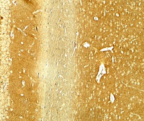 SNCA / Alpha-Synuclein Antibody - Immunohistochemistry of SNCA in rat brain tissue with SNCA antibody at 5 ug/ml.