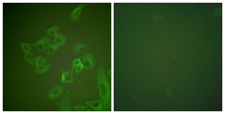 SNCB / Beta-Synuclein Antibody - Immunofluorescence analysis of A549 cells, using Synuclein beta Antibody. The picture on the right is blocked with the synthesized peptide.