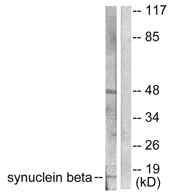 SNCB / Beta-Synuclein Antibody - Western blot analysis of lysates from HeLa cells, using Synuclein beta Antibody. The lane on the right is blocked with the synthesized peptide.