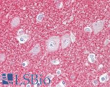 SNCB / Beta-Synuclein Antibody - Anti-SNCB / Beta-Synuclein antibody IHC of human brain, cortex. Immunohistochemistry of formalin-fixed, paraffin-embedded tissue after heat-induced antigen retrieval. Antibody dilution 1:100.