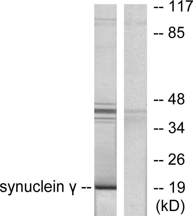 SNCG / Gamma-Synuclein Antibody - Western blot analysis of lysates from HT29 cells, using Synuclein gamma Antibody. The lane on the right is blocked with the synthesized peptide.