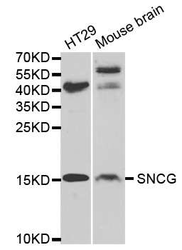 SNCG / Gamma-Synuclein Antibody - Western blot analysis of extracts of various cell lines, using SNCG antibody.