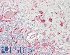 SNCG / Gamma-Synuclein Antibody - Human Brain, Cerebellum: Formalin-Fixed, Paraffin-Embedded (FFPE)