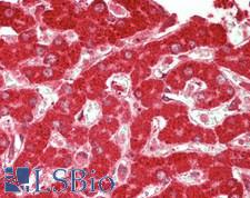 SND1 Antibody - Human Liver: Formalin-Fixed, Paraffin-Embedded (FFPE)