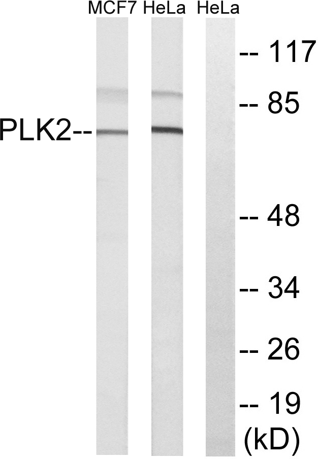 SNK / PLK2 Antibody - Western blot analysis of lysates from HeLa and MCF-7 cells, using PLK2 Antibody. The lane on the right is blocked with the synthesized peptide.