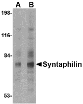 SNPH Antibody - Western blot of Syntaphilin in human brain tissue lysate with Syntaphilin antibody at (A) 2 and (B) 4 ug/ml.