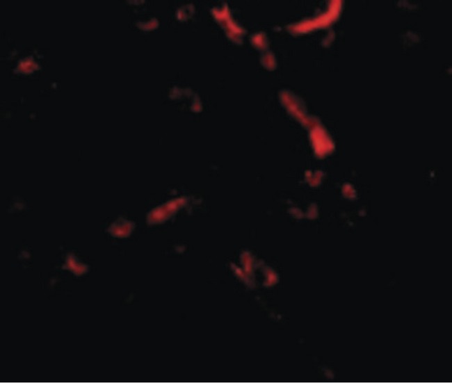 SNPH Antibody - Immunofluorescence of Syntaphilin in Human Brain cells with Syntaphilin antibody at 20 ug/ml.