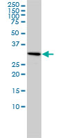 SNRPA / U1A Antibody - SNRPA monoclonal antibody (M01), clone 3F9-1F7 Western blot of SNRPA expression in HeLa.