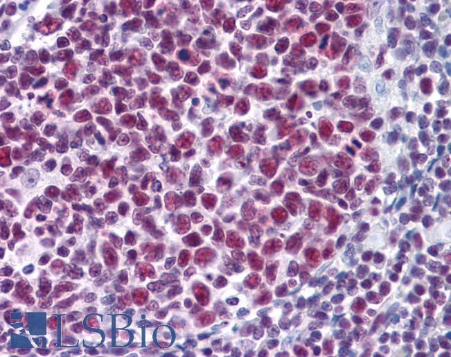 SNRPA / U1A Antibody - Anti-SNRPA antibody IHC of human tonsil. Immunohistochemistry of formalin-fixed, paraffin-embedded tissue after heat-induced antigen retrieval. Antibody concentration 5 ug/ml.