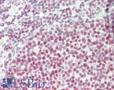 SNRPD3 Antibody - Human Tonsil: Formalin-Fixed, Paraffin-Embedded (FFPE)