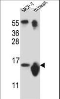 SNRPD3 Antibody - SNRPD3 Antibody western blot of MCF-7 cell line and mouse heart tissue lysates (35 ug/lane). The SNRPD3 antibody detected the SNRPD3 protein (arrow).