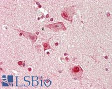 SNRPD3 Antibody - Human Brain, Cortex: Formalin-Fixed, Paraffin-Embedded (FFPE)