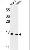 SNRPD3 Antibody - Western blot of SNRPD3 Antibody in MCF-7, Jurkat cell line lysates (35 ug/lane). SNRPD3 (arrow) was detected using the purified antibody.