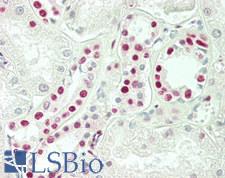 SNRPD3 Antibody - Human Kidney: Formalin-Fixed, Paraffin-Embedded (FFPE)