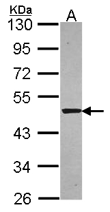 SNTA1 / Syntrophin Alpha 1 Antibody - Sample (30 ug of whole cell lysate). A: A549. 10% SDS PAGE. SNTA1 / Syntrophin Alpha 1 antibody diluted at 1:5000.
