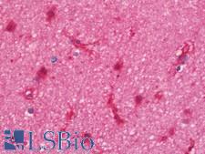 SNTA1 / Syntrophin Alpha 1 Antibody - Anti-SNTA1 / Syntrophin Alpha 1 antibody IHC staining of human brain, cortex. Immunohistochemistry of formalin-fixed, paraffin-embedded tissue after heat-induced antigen retrieval. Antibody concentration 7.5 ug/ml.