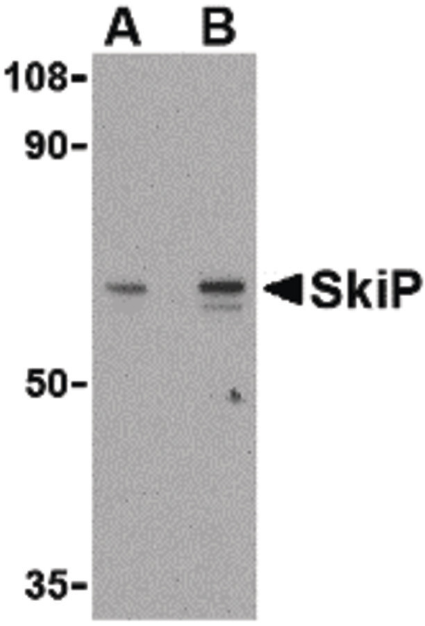 SNW1 / SKIP Antibody - Western blot of SkiP in mouse skeletal muscle tissue lysate with SkiP antibody at (A) 0.5 and (B) 1 ug/ml.