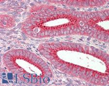 SNX1 Antibody - Anti-SNX1 antibody IHC staining of human uterus. Immunohistochemistry of formalin-fixed, paraffin-embedded tissue after heat-induced antigen retrieval.