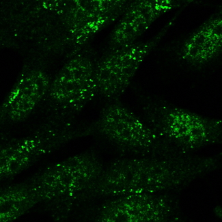 SNX1 Antibody - Goat Anti-SNX1 Antibody (5ug/ml) staining of formaldehyde-fixed SH5Y5Y and detected with Alexa 488 in confocal microscopy. Data obtained from Dr. Schallburg Nielsen, Aarhus University Denmark.
