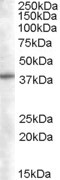 SNX16 Antibody - Antibody (0.05 ug/ml) staining of Daudi lysate (35 ug protein in RIPA buffer). Primary incubation was 1 hour. Detected by chemiluminescence.