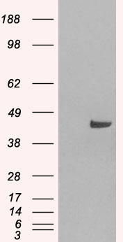 SNX16 Antibody - SNX16 antibody (0.05µg/ml) staining of Daudi lysate (35µg protein in RIPA buffer). Primary incubation was 1 hour. Detected by chemiluminescence.