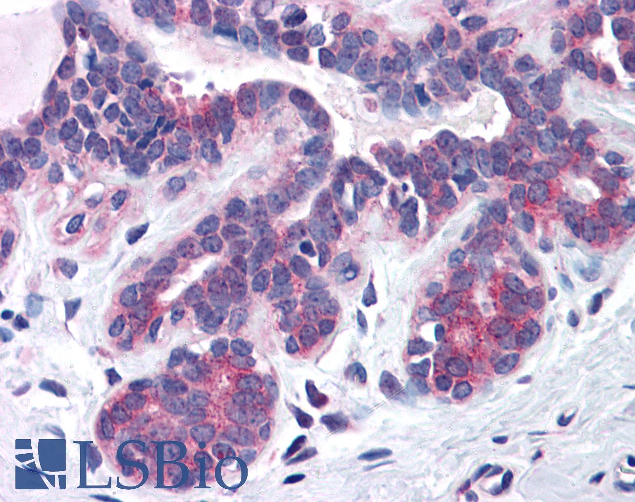 SNX16 Antibody - Anti-SNX16 antibody IHC of human breast. Immunohistochemistry of formalin-fixed, paraffin-embedded tissue after heat-induced antigen retrieval. Antibody concentration 3.75 ug/ml.