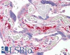SNX2 Antibody - Anti-SNX2 antibody IHC of human placenta. Immunohistochemistry of formalin-fixed, paraffin-embedded tissue after heat-induced antigen retrieval. Antibody concentration 10 ug/ml.