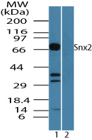 SNX2 Antibody - Western blot of Snx2 in mouse placenta lysate in the 1) absence and 2) presence of immunizing peptide using SNX2 Antibody at 0.25 ug/ml.