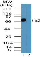 SNX2 Antibody - Western blot of Snx2 in mouse placenta lysate in the 1) absence and 2) presence of immunizing peptide using SNX2 Antibody at 0.1 ug/ml.