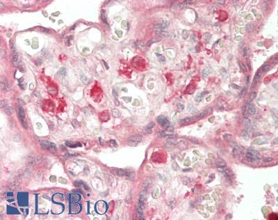 SNX20 Antibody - Human Placenta: Formalin-Fixed, Paraffin-Embedded (FFPE)