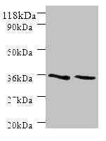 SNX20 Antibody - Western blot All lanes: SNX20 antibody at 2µg/ml Lane 1: Mouse spleen tissue Lane 2: Mouse skeletal muscle tissue Secondary Goat polyclonal to rabbit IgG at 1/10000 dilution Predicted band size: 37, 18, 15, 12 kDa Observed band size: 37 kDa