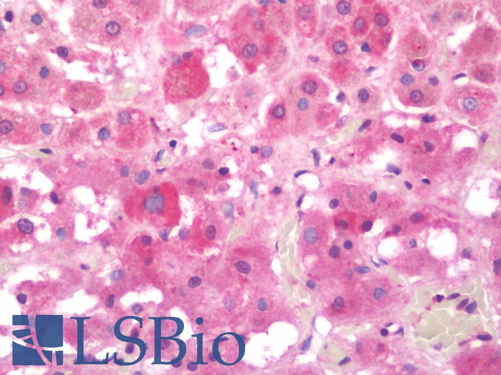 SNX3 Antibody - Anti-SNX3 antibody IHC staining of human adrenal. Immunohistochemistry of formalin-fixed, paraffin-embedded tissue after heat-induced antigen retrieval. Antibody concentration 10 ug/ml.  This image was taken for the unconjugated form of this product. Other forms have not been tested.