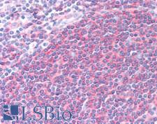 SNX8 Antibody - Human Tonsil: Formalin-Fixed, Paraffin-Embedded (FFPE), at a concentration of 10 µg/ml.