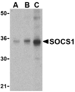 SOCS1 Antibody - Western blot of SOCS1 in Human spleen cell lysate with SOCS1 antibody at (A) 1, (B) 2 and (C) 4 ug/ml.