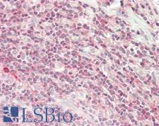 SOD1 / Cu-Zn SOD Antibody - Human Tonsil: Formalin-Fixed, Paraffin-Embedded (FFPE)