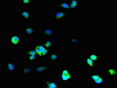 SOD1 / Cu-Zn SOD Antibody - Immunofluorescent analysis of 293T cells using SOD1 Antibody at dilution of 1:100 and Alexa Fluor 488-congugated AffiniPure Goat Anti-Rabbit IgG(H+L)