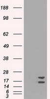SOD1 / Cu-Zn SOD Antibody - HEK293T cells were transfected with the pCMV6-ENTRY control (Left lane) or pCMV6-ENTRY SOD1 (Right lane) cDNA for 48 hrs and lysed. Equivalent amounts of cell lysates (5 ug per lane) were separated by SDS-PAGE and immunoblotted with anti-SOD1.