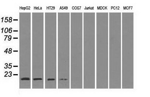 SOD1 / Cu-Zn SOD Antibody - Western blot of extracts (35 ug) from 9 different cell lines by using anti-SOD1 monoclonal antibody.