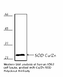 SOD1 / Cu-Zn SOD Antibody