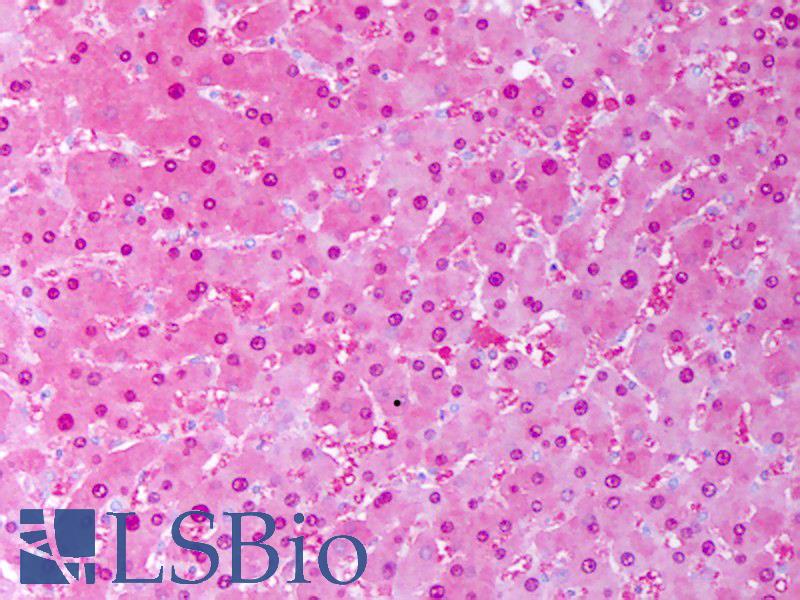SOD1 / Cu-Zn SOD Antibody - Anti-SOD1 antibody IHC of human liver, hephatocytes. Immunohistochemistry of formalin-fixed, paraffin-embedded tissue after heat-induced antigen retrieval. Antibody concentration 10 ug/ml.  This image was taken for the unconjugated form of this product. Other forms have not been tested.