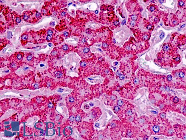 SOD1 / Cu-Zn SOD Antibody - Anti-SOD1 / SOD antibody IHC staining of human liver. Immunohistochemistry of formalin-fixed, paraffin-embedded tissue after heat-induced antigen retrieval.