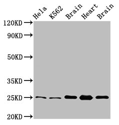 SOD2 / Mn SOD Antibody - Western Blot Positive WB detected in: Hela whole cell lysate, K562 whole cell lysate, Rat brain tissue, Rat heart tissue, Mouse brain tissu All lanes: SOD2 antibody at 3.4µg/ml Secondary Goat polyclonal to rabbit IgG at 1/50000 dilution Predicted band size: 25, 21, 19, 20 kDa Observed band size: 25 kDa