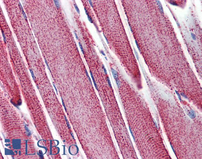 SOD2 / Mn SOD Antibody - Anti-SOD2 / MNSOD antibody IHC of human skeletal muscle. Immunohistochemistry of formalin-fixed, paraffin-embedded tissue after heat-induced antigen retrieval. Antibody concentration 10 ug/ml.