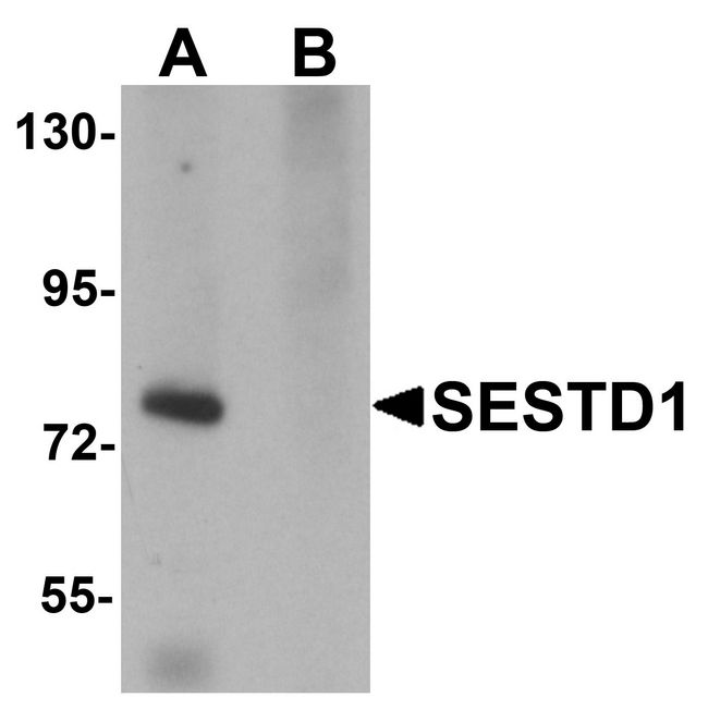 SOLO / SESTD1 Antibody - Western blot analysis of SESTD1 in rat brain tissue lysate with SESTD1 antibody at 1 ug/ml in (A) the absence and (B) the presence of blocking peptide.
