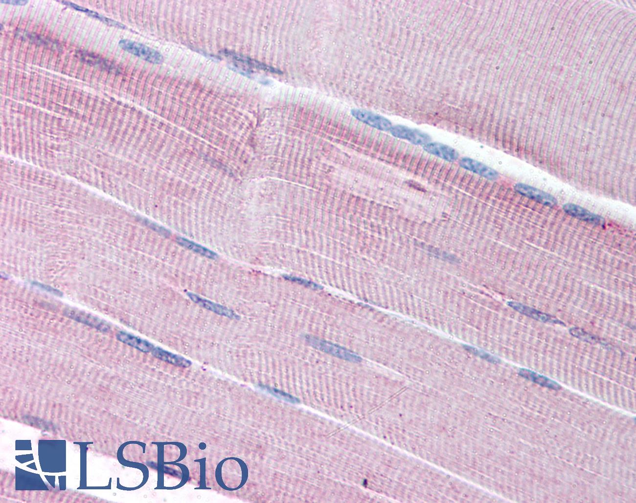 SORBS1 / Ponsin Antibody - Anti-SORBS1 antibody IHC of human skeletal muscle. Immunohistochemistry of formalin-fixed, paraffin-embedded tissue after heat-induced antigen retrieval. Antibody concentration 5 ug/ml.