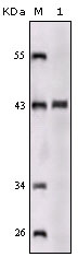 SORL1 Antibody - Western blot using SORL1 mouse monoclonal antibody against truncated SORL1 recombinant protein.