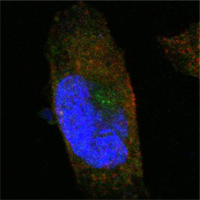 SORL1 Antibody - Confocal immunofluorescence of PANC-1 cells using SORL1 mouse monoclonal antibody (green). Red: Actin filaments have been labeled with Alexa Fluor-555 phalloidin. Blue: DRAQ5 fluorescent DNA dye.
