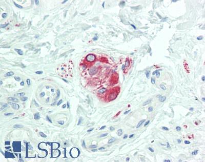 SOS1 Antibody - Human Colon, Submucosal Plexus: Formalin-Fixed, Paraffin-Embedded (FFPE), at a dilution of 1:100.